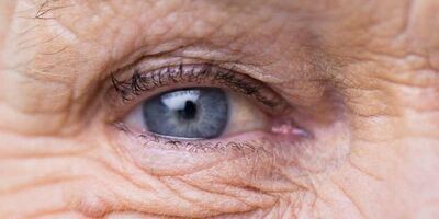 داروهای کلسترول و دیابت ریسک بیماری چشمی را کاهش می دهند