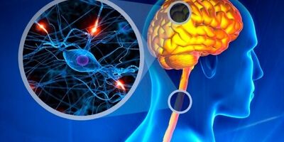شرح یک بیماری خودایمنی و علائم پیشرفت آن در زنان

