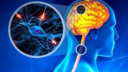 شرح یک بیماری خودایمنی و علائم پیشرفت آن در زنان
