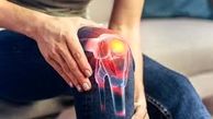 چطور به کاهش درد های زانو کمک کنیم؟
