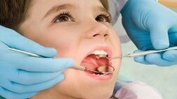 بیمه سلامت کدام خدمات دندانپزشکی را پوشش می‌دهد؟