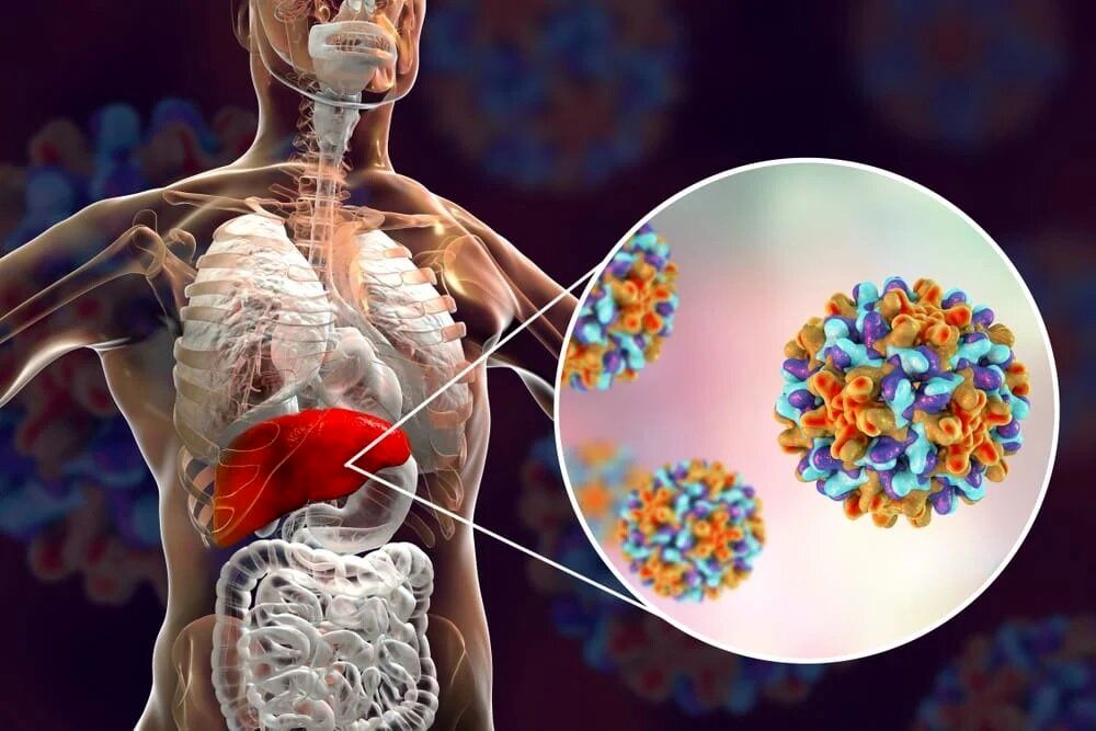 علائم، راههای انتقال و روشهای پیشگیری و درمان هپاتیت
