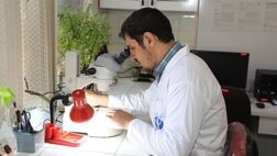 سالانه یک میلیون مورد مرگ ناشی از بیماری‌های انگلی در دنیا رخ می‌دهد