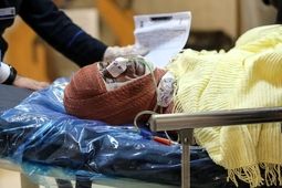 کمبود هزار تخت بیمارستانی سوختگی در کشور
