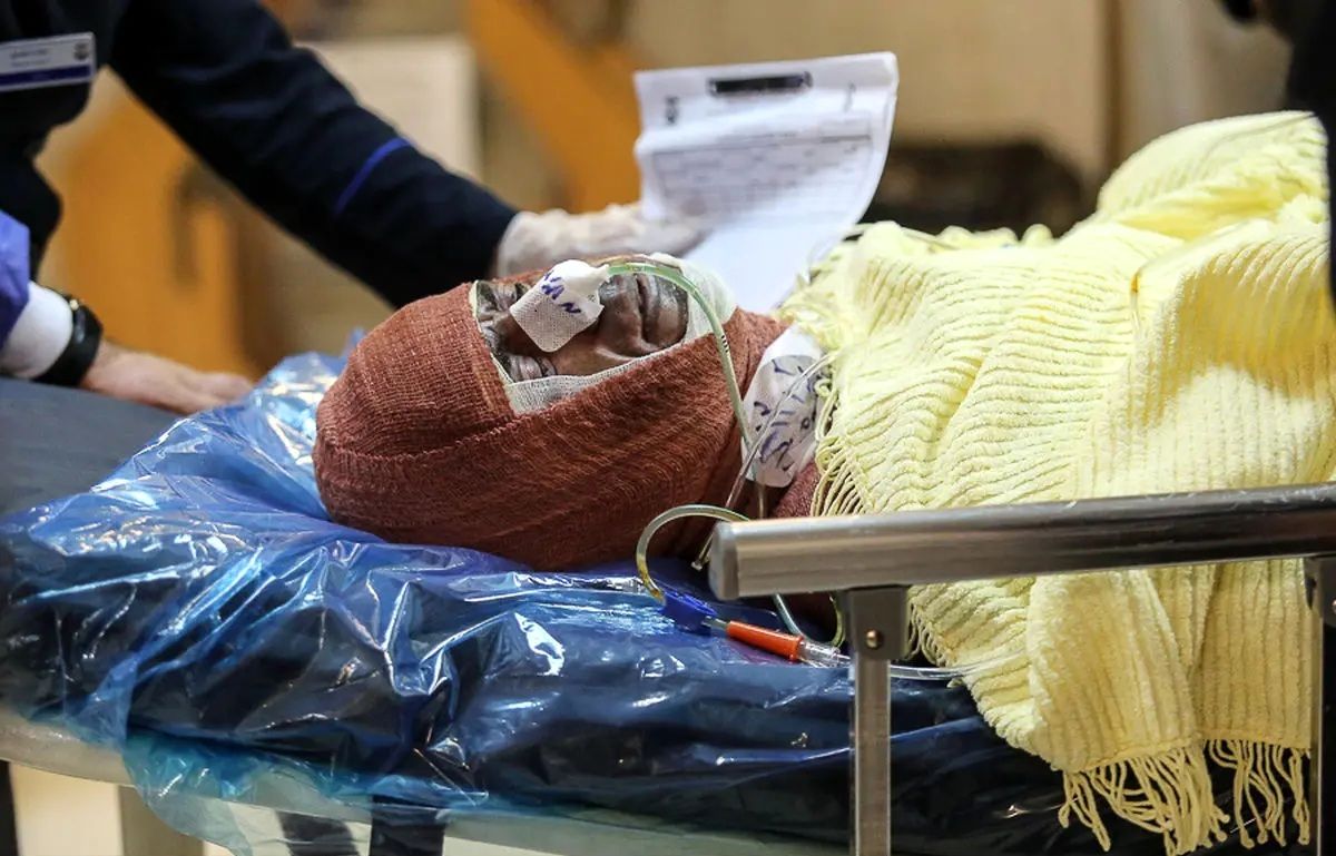 کمبود هزار تخت بیمارستانی سوختگی در کشور
