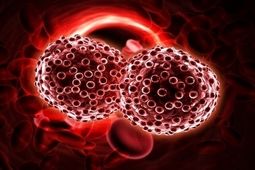 سرطان‌های حاد خون با علائم شدید و سریع بروز می‌کنند