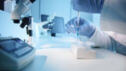 
۸۰ درصد کیت‌های آزمایشگاهی مورد استفاده تولید داخل هستند