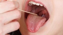 نقش لوزه‌ها در سیستم ایمنی بدن

