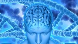 ارتباط بین سندرم داون و بیماری آلزایمر