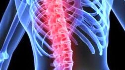 تحریک طناب نخاعی در کاهش نوروپاتی دیابتی موثر است