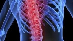 تحریک طناب نخاعی در کاهش نوروپاتی دیابتی موثر است