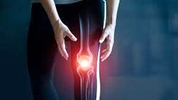 کدام خوراکی‌ها برای مبتلایان به آرتروز مناسب نیست؟