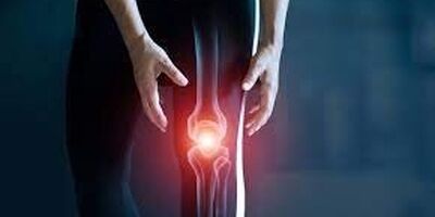 کدام خوراکی‌ها برای مبتلایان به آرتروز مناسب نیست؟