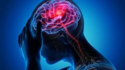 پیش‌بینی خطر سکته مغزی با آزمایش چشم
