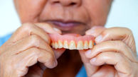 آیا بیمه تامین اجتماعی هزینه دندان مصنوعی را می‌دهد؟
