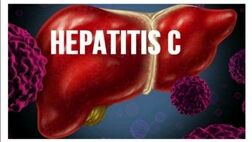 همه چیز درباره بیماری هپاتیت C