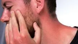 راهکارهای تسکین پوست آفتاب سوخته چیست؟