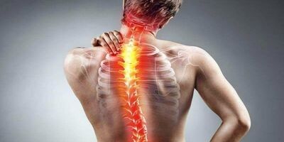 سیاتیک چیست؟ تعریف، علائم و روش درمان
