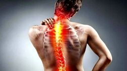 سیاتیک چیست؟ تعریف، علائم و روش درمان
