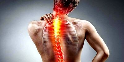 سیاتیک چیست؟ تعریف، علائم و روش درمان
