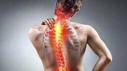 سیاتیک چیست؟ تعریف، علائم و روش درمان
