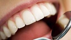 جرم‌گیری پایه‌ای‌ترین درمان دندانپزشکی و بی‌ضرر است
