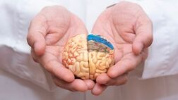 پیشگیری از آلزایمر در افراد مبتلا به سندرم داون با شناسایی عاملی جدید