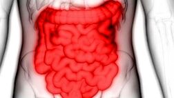 تغییرات لایه مخاطی روده عامل بروز کولیت روده