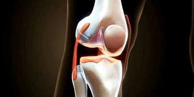 کاهش دردهای آرتروز با مصرف این خوراکی مفید
