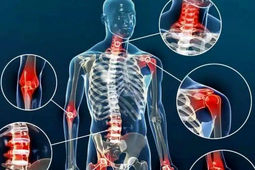 راز داشتن استخوان‌های قوی در هر سن چیست؟
