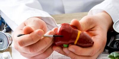 چه بخوریم که برای کبد چرب مفید باشد؟