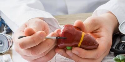 چه بخوریم که برای کبد چرب مفید باشد؟