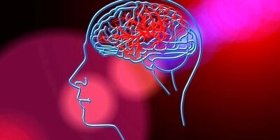 پیشگیری ۸۰ درصدی از سکته‌های مغزی با این دو اقدام
