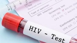 مبتلایان به HIV چگونه می‌توانند زندگی با کیفیتی داشته باشند؟

