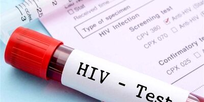 مبتلایان به HIV چگونه می‌توانند زندگی با کیفیتی داشته باشند؟
