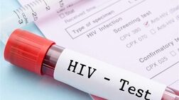 مبتلایان به HIV چگونه می‌توانند زندگی با کیفیتی داشته باشند؟
