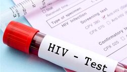 HIV چه زمانی به ایدز تبدیل می‌شود؟