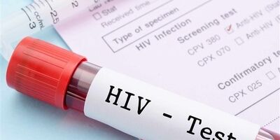 HIV چه زمانی به ایدز تبدیل می‌شود؟