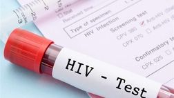 HIV چه زمانی به ایدز تبدیل می‌شود؟