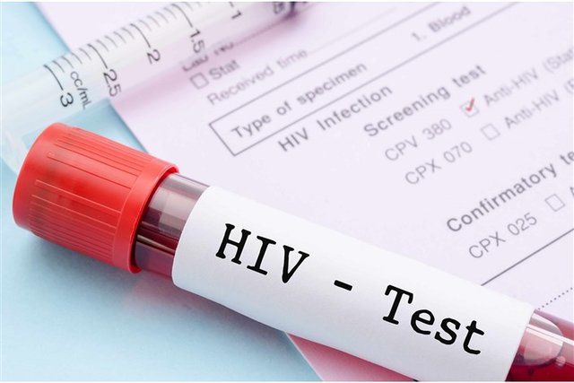 HIV چه زمانی به ایدز تبدیل می‌شود؟