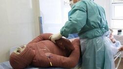 میزان سوختگی در ایران8 برابر میانگین جهانی است
