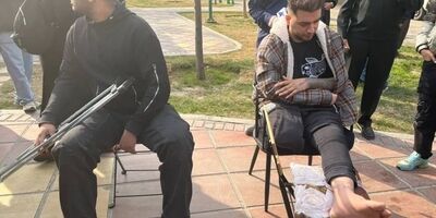 قطع پای پسرجوان در حمله مردان مسلح خشن
